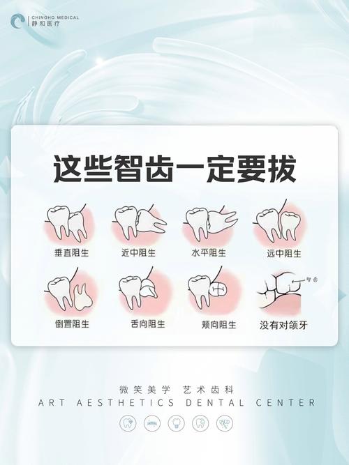 正畸过程中智齿可以拔除吗？-图2