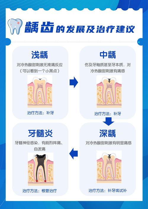 儿童深龋治疗有哪些常用的有效治疗方法?-图3 儿童深龋治疗有哪些常用的有效治疗方法?-图3