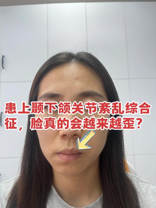 正畸后为何会出现颞颌关节紊乱问题？-图1