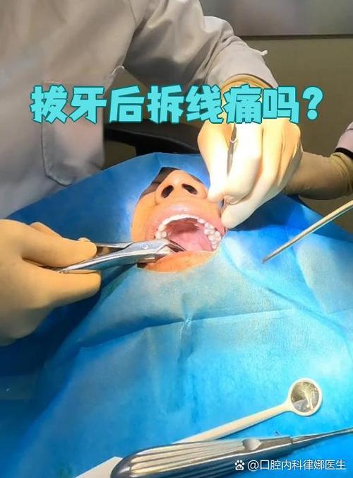 口腔内拆线怎么拆才正确?拆线后要注意什么?-图3 口腔内拆线怎么拆才正确?拆线后要注意什么?-图3
