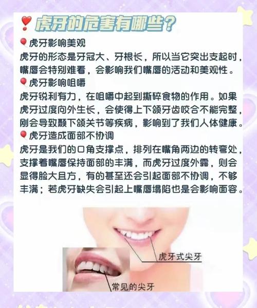 虎牙矫正有哪些常用矫正方法?-图1 虎牙矫正有哪些常用矫正方法?-图1