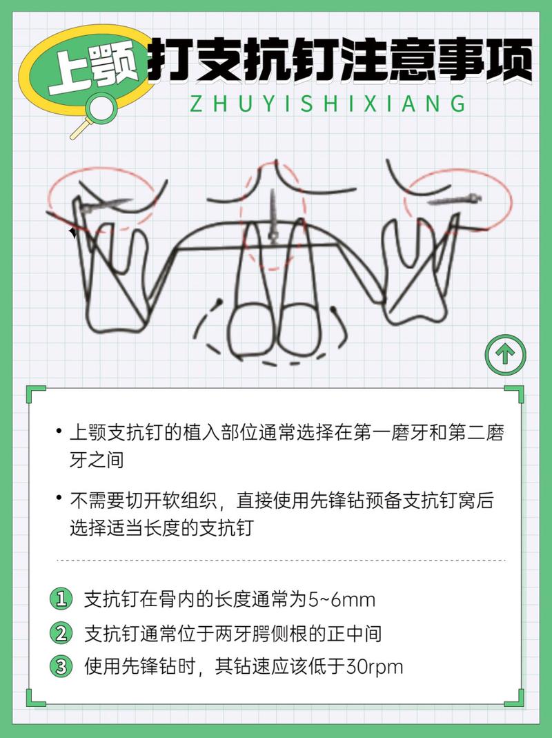 正畸支抗钉转动方向有何讲究？-图2