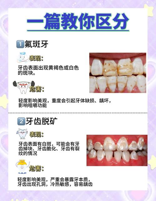 牙齿上变白的方法-图3