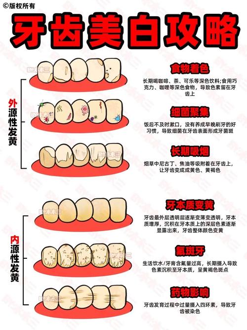 家庭牙齿美白方法安全有效吗？-图2