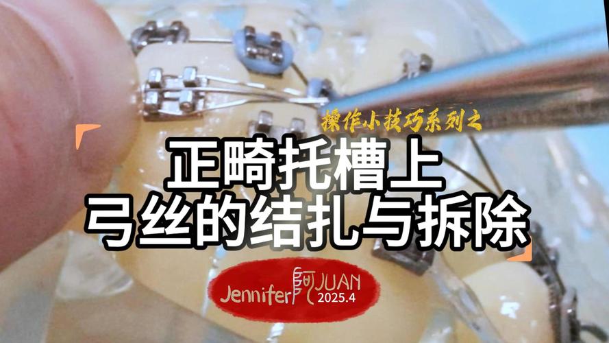 拆托槽如何正确操作？方法不当会有什么影响？-图2