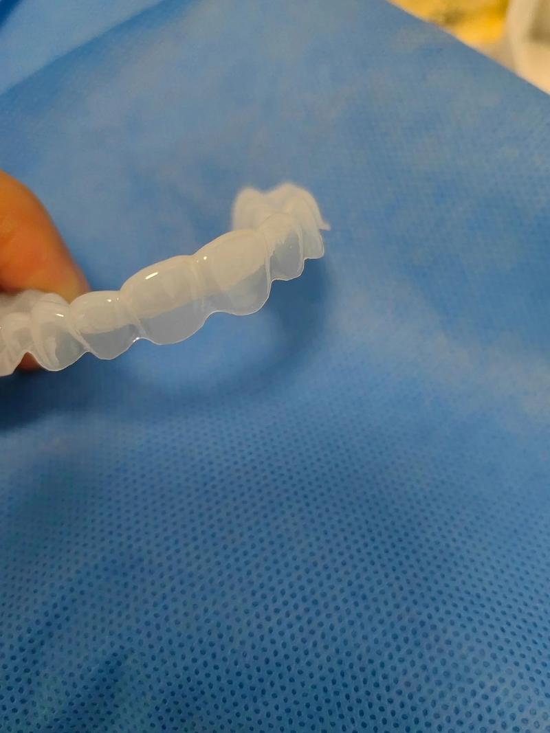 正畸后保持器该用什么材质制作？哪种更合适？-图2