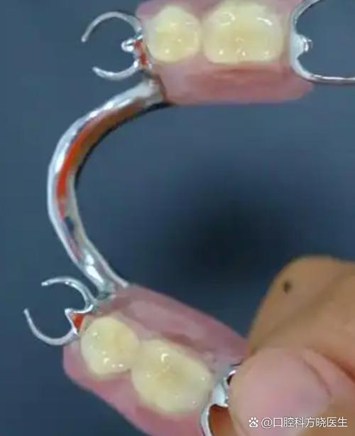 假牙取下来的正确方法和步骤是什么？-图2