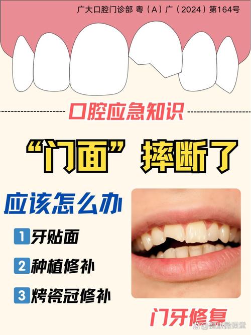 牙齿断裂后，如何选择合适的恢复治疗方法？-图2