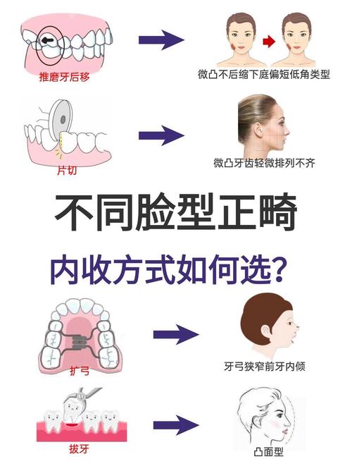 矫正牙齿内收有哪些有效方法？如何选择？-图2