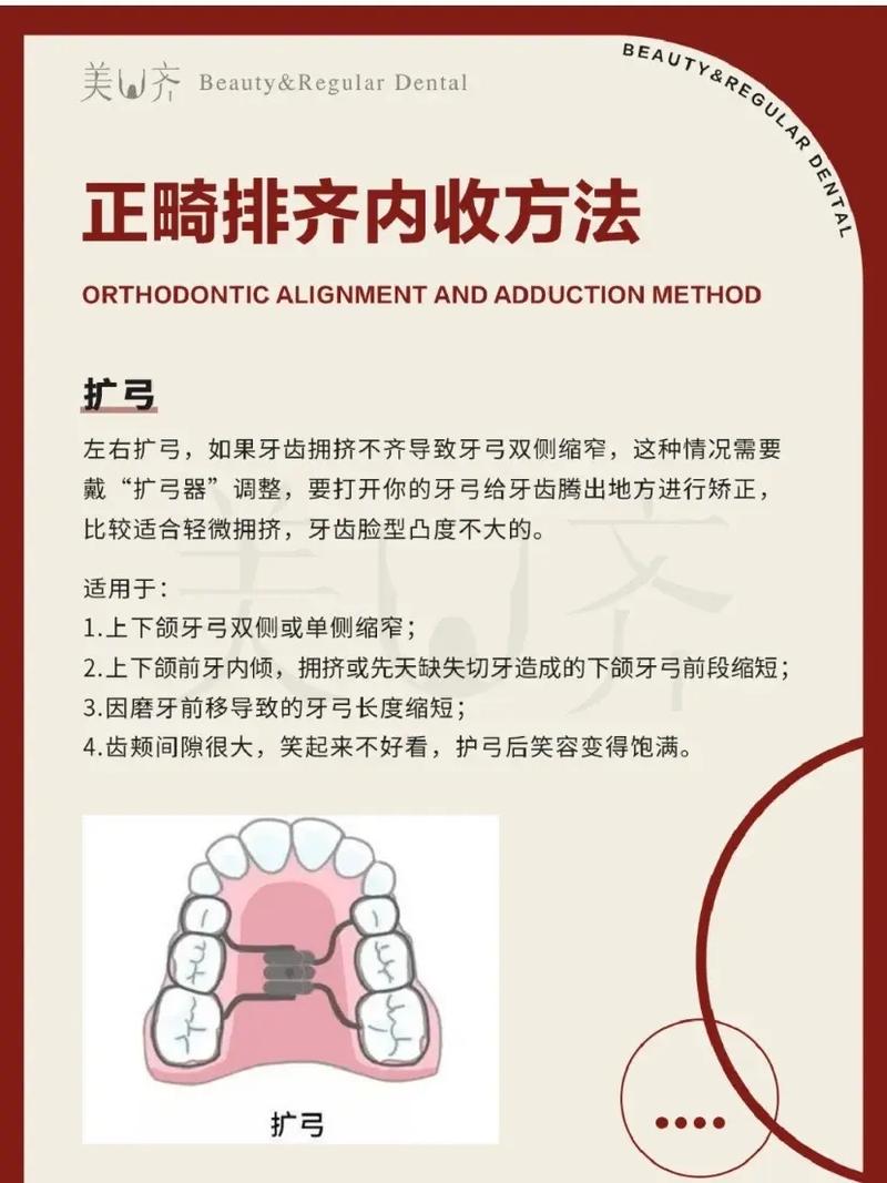 矫正牙齿内收有哪些有效方法？如何选择？-图3