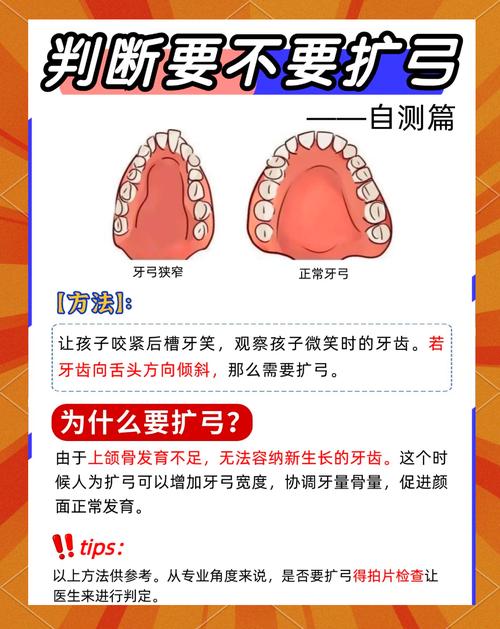 儿童正畸扩弓方法有哪些？哪种更适合孩子？-图3