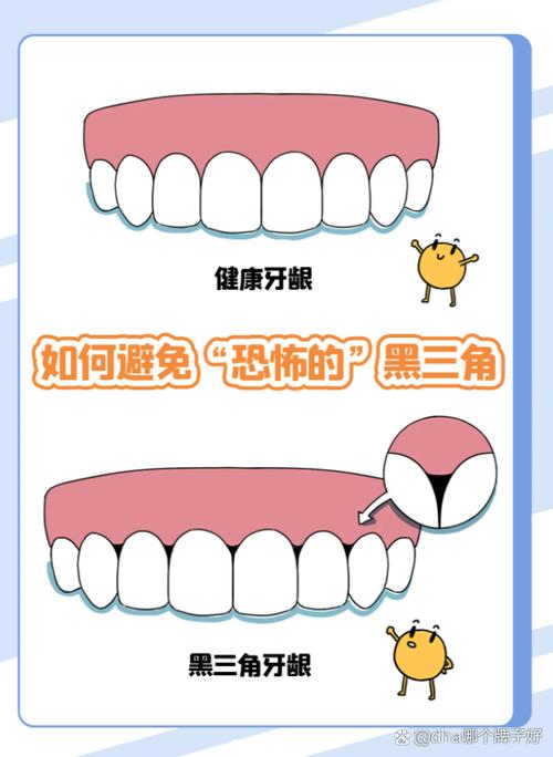 牙龈发炎会影响正畸治疗的顺利进行吗？-图1