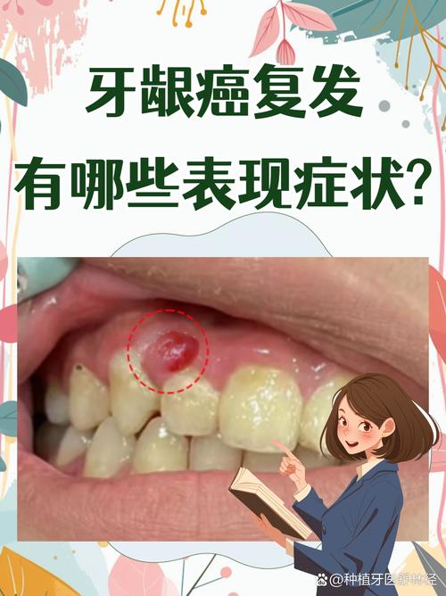 种牙后会有不适吗？一般持续多久？-图3