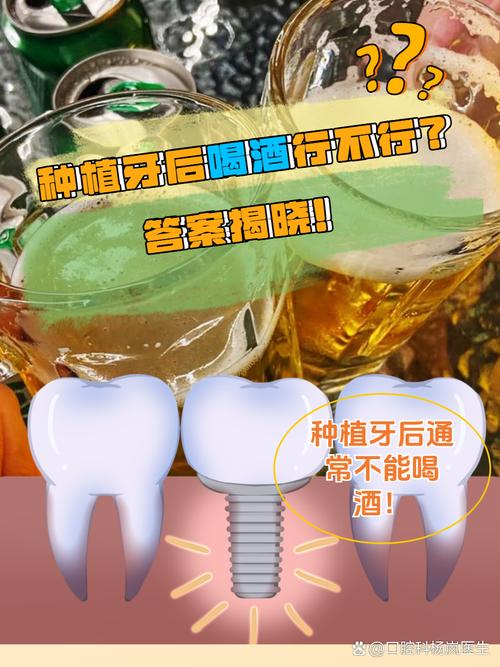种牙后可以饮酒吗？这些影响需了解-图2