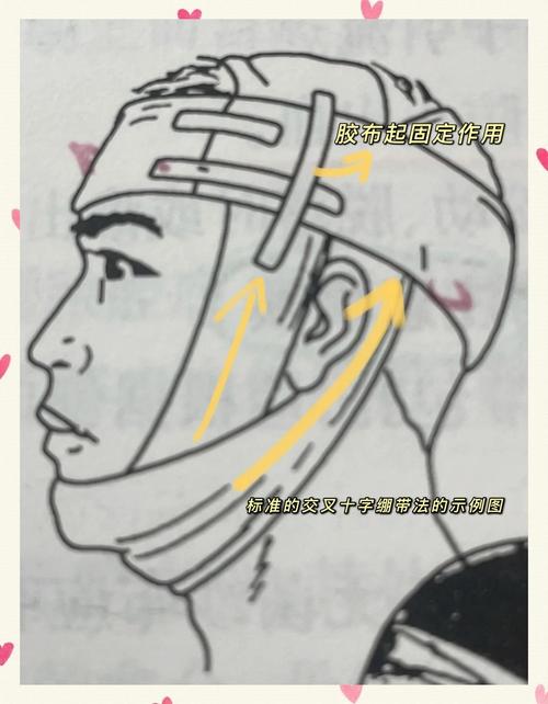 口腔矫治结扎方法如何选择与规范操作？-图1