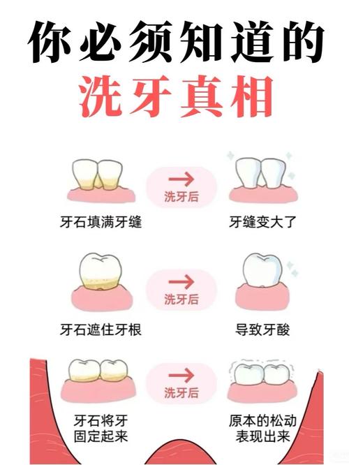 牙周炎有简易除法吗？这些方法真的有效吗？-图3