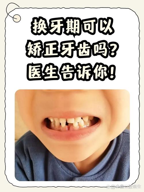 上海儿童牙齿正畸疼吗-图1