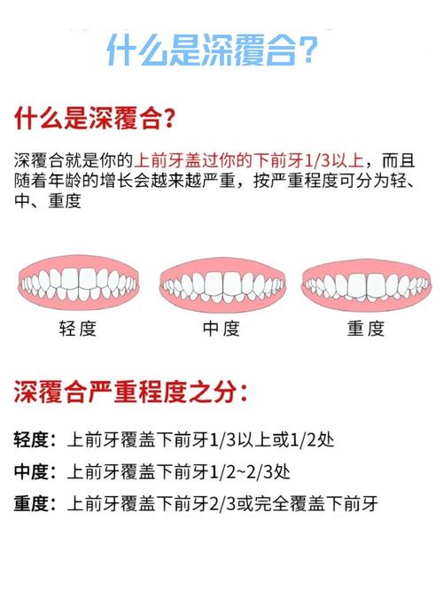 正畸压低上后牙的常用方法有哪些？-图1