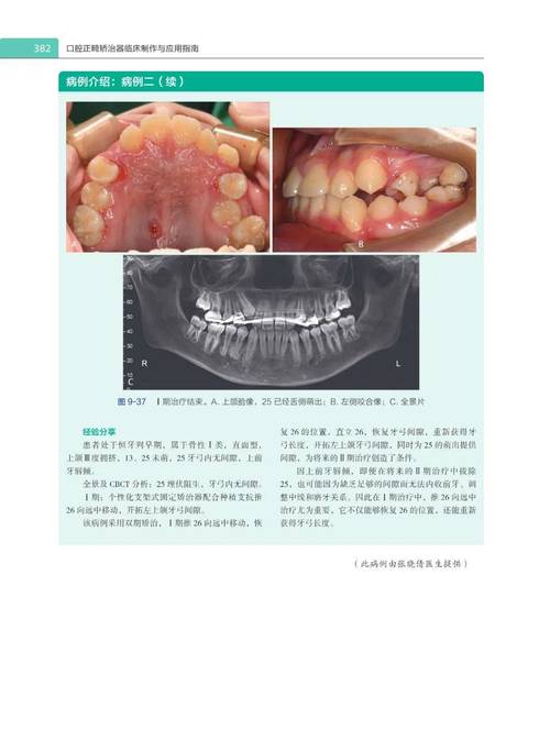 这本书有何临床价值？适合哪些正畸读者？-图1