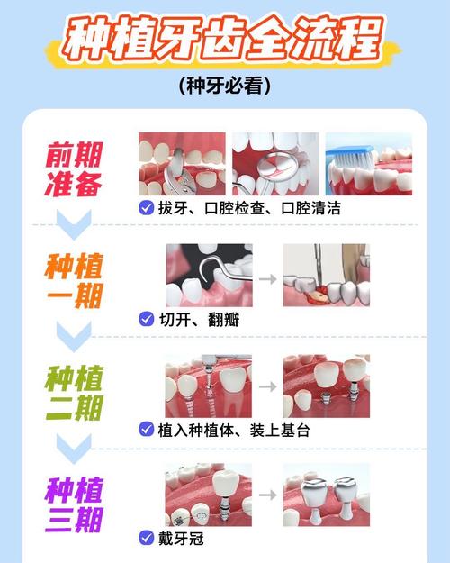 种牙前必须洁牙马-图1