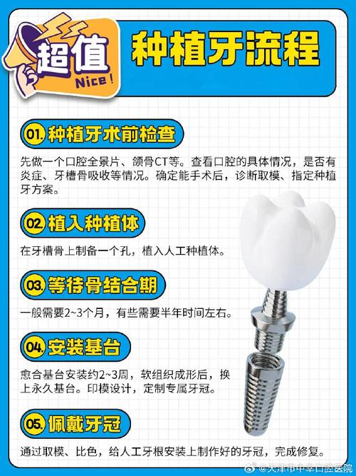 口腔种植的正确方法究竟该如何正确操作？-图2