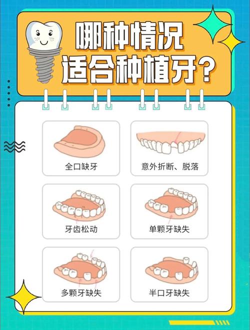 牙齿稀疏一定要种牙吗？别忽视这些选择-图1