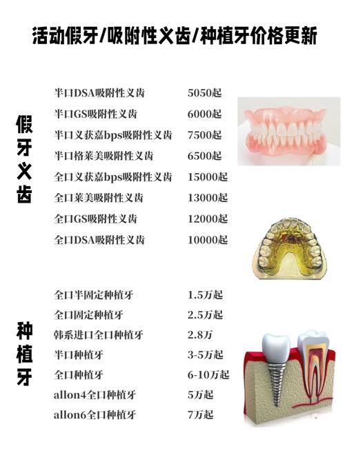 精密附着体种牙的优势体现在哪些方面？-图2