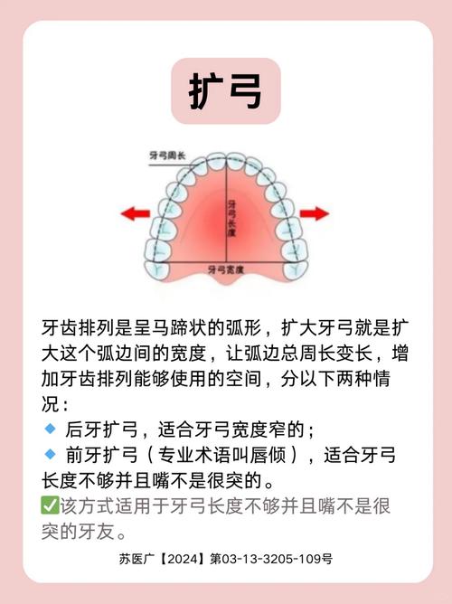 牙齿扭转的治疗方法有哪些具体方案？-图3