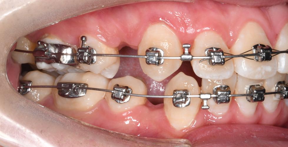 2025口腔正畸进修，哪些前沿方向值得关注？-图2