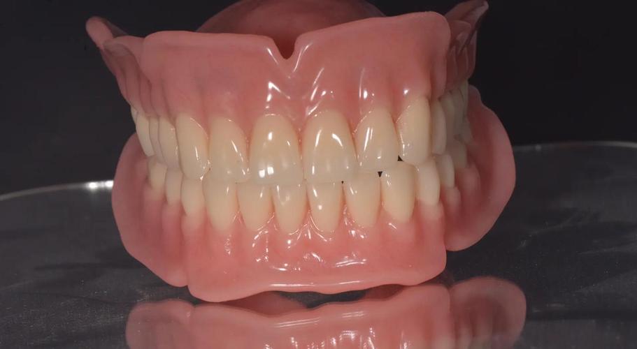 全口义齿修复,种牙真的是更好选择吗?-图1 全口义齿修复,种牙真的是更好选择吗?-图1