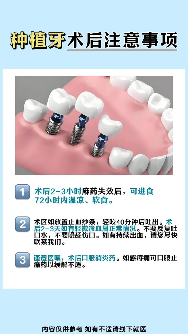 种牙后需保养吗？日常护理该注意什么？-图1