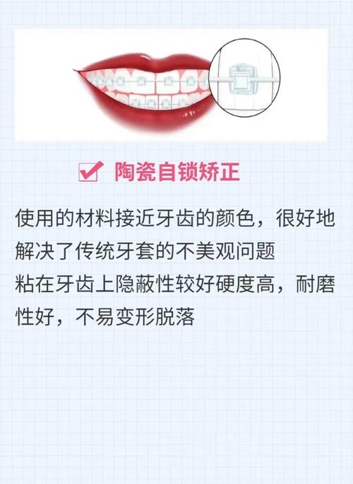 正畸主动自锁托槽是什么？原理优势说明-图2