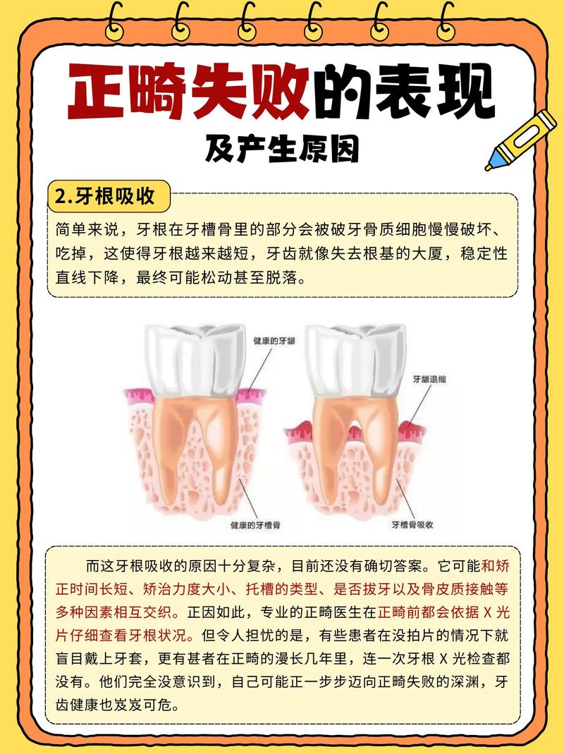 口腔正畸治疗过程中可能存在哪些危害？-图3