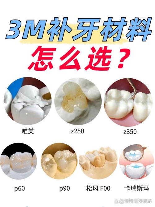 纳米树脂补牙方法效果如何？优势有哪些？-图3