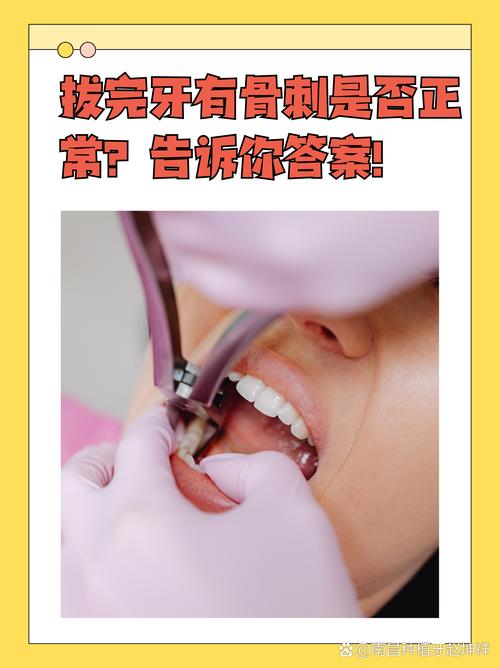 如何掌握下颌尖牙拔出方法？关键步骤有哪些？-图2