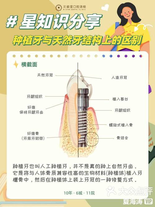 在进行种牙手术时,上颌骨厚度会受到怎样的影响?-图2 在进行种牙手术时,上颌骨厚度会受到怎样的影响?-图2