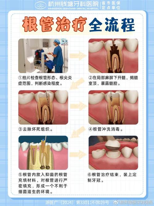 根尖穿孔如何有效拯救？方法有哪些？-图1