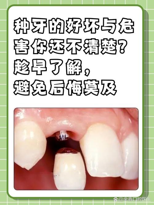 种牙术后有哪些事情绝对不能做？-图1