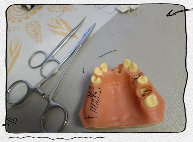 口腔手术缝合方法如何正确选择与操作?-图3 口腔手术缝合方法如何正确选择与操作?-图3