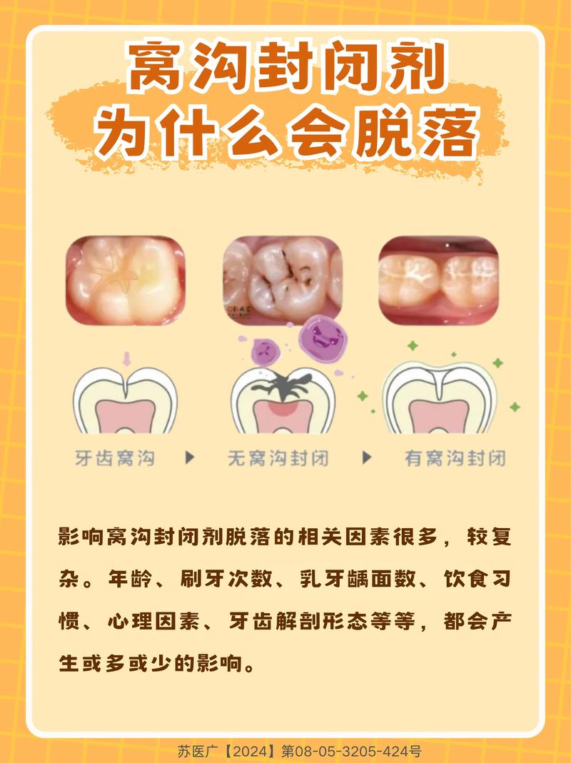 龋齿封闭治疗的效果和适用人群有哪些?-图1 龋齿封闭治疗的效果和适用人群有哪些?-图1