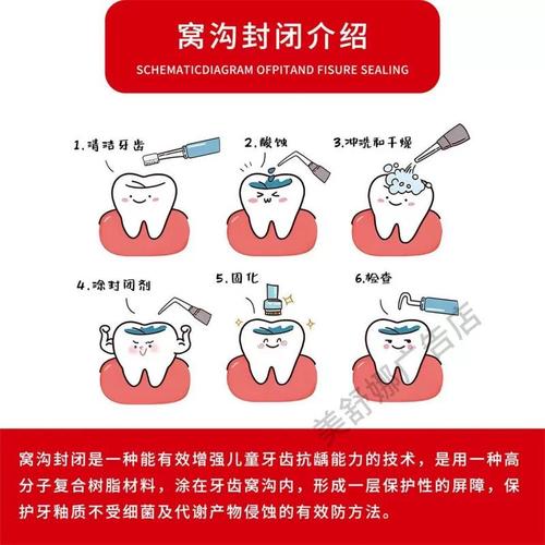 龋齿封闭治疗的效果和适用人群有哪些?-图2 龋齿封闭治疗的效果和适用人群有哪些?-图2