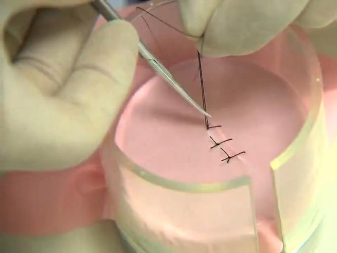 口腔常用缝合方法有哪些？如何选择合适的方法？-图1