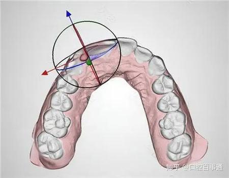 北京牙齿正畸去哪里找靠谱的正规牙科医院？-图2