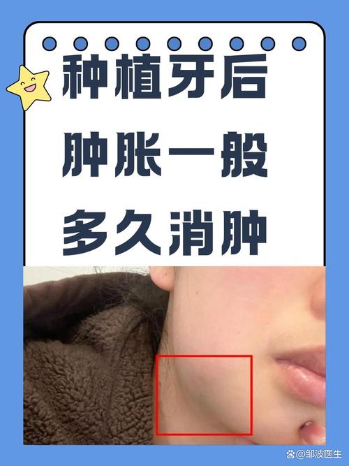 种牙后麻木感会随时间消退吗？-图1