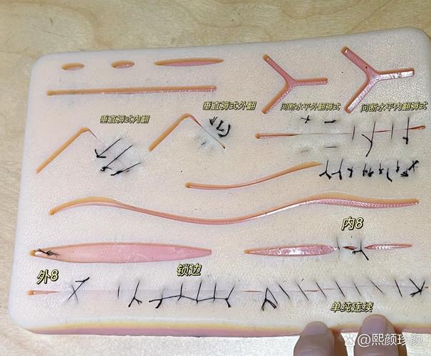 种植缝合方法图解，缝合技巧有哪些图解步骤？-图3