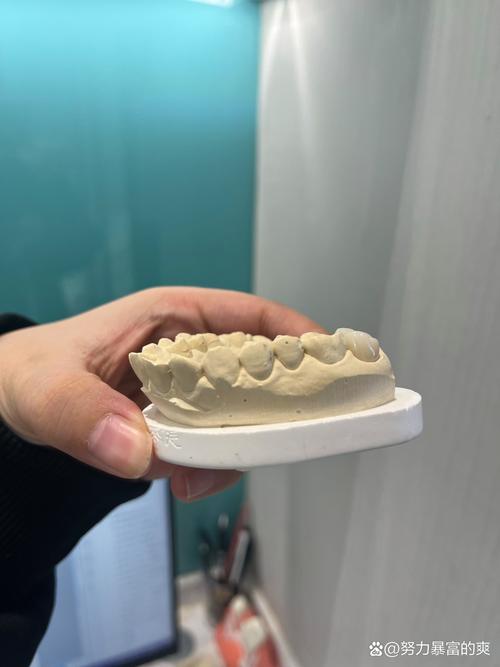 沈阳阳光口腔种牙效果好不好？价格贵不贵？靠谱吗？-图2