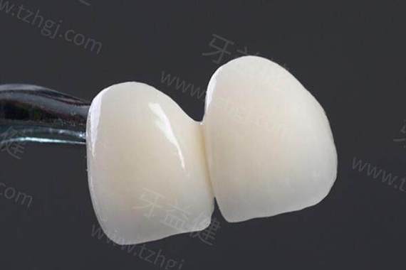 种牙后牙冠品牌怎么选？有哪些靠谱品牌推荐？-图3