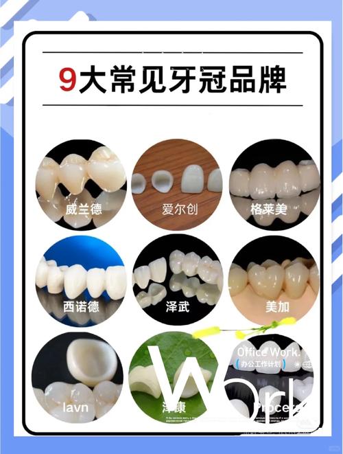 种牙后牙冠品牌怎么选？有哪些靠谱品牌推荐？-图2