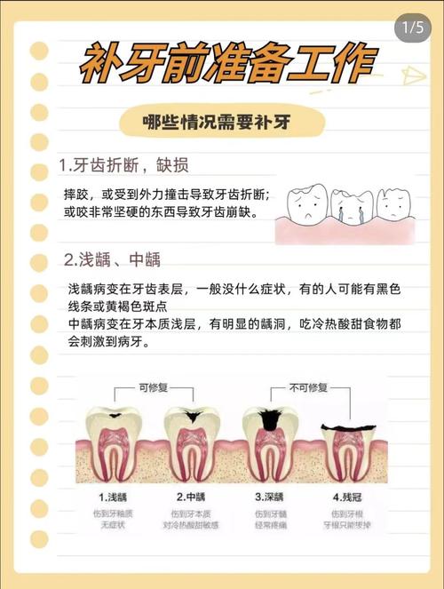 补牙常见方法有哪些？哪种更适合自己？-图3