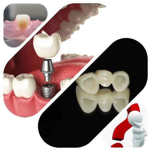 活动假牙如何稳固不掉？实用方法有哪些？-图1